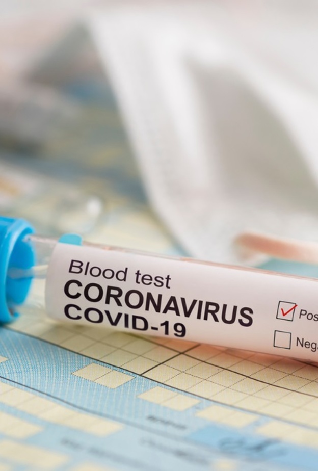 فيروس كورونا يبقى حياً في الهواء لعدة ساعات