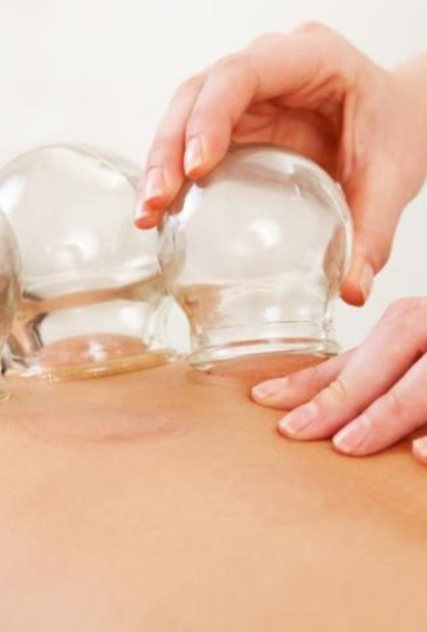 الحجامة الوقائية امل من الحجامة العلاجية