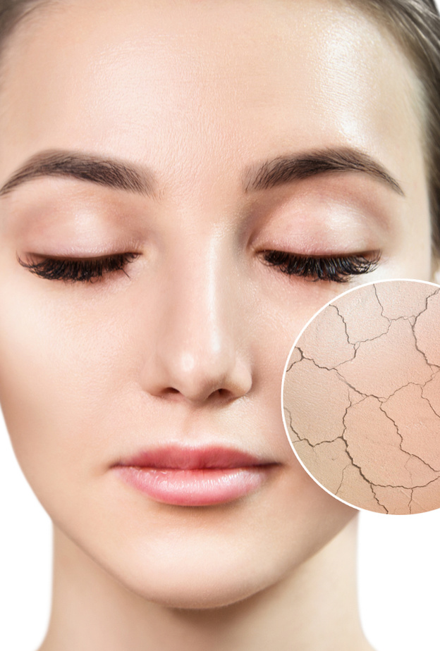 إغسلي وجهك للتخلص من قشرة الوجه