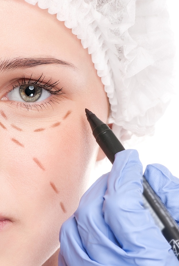  تخلصي من العيون المبطنة من خلال حقن الفيلر