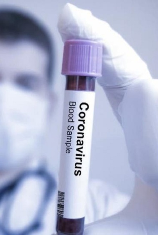  فيروس كورونا له مضاعفات خطيرة على الصحة