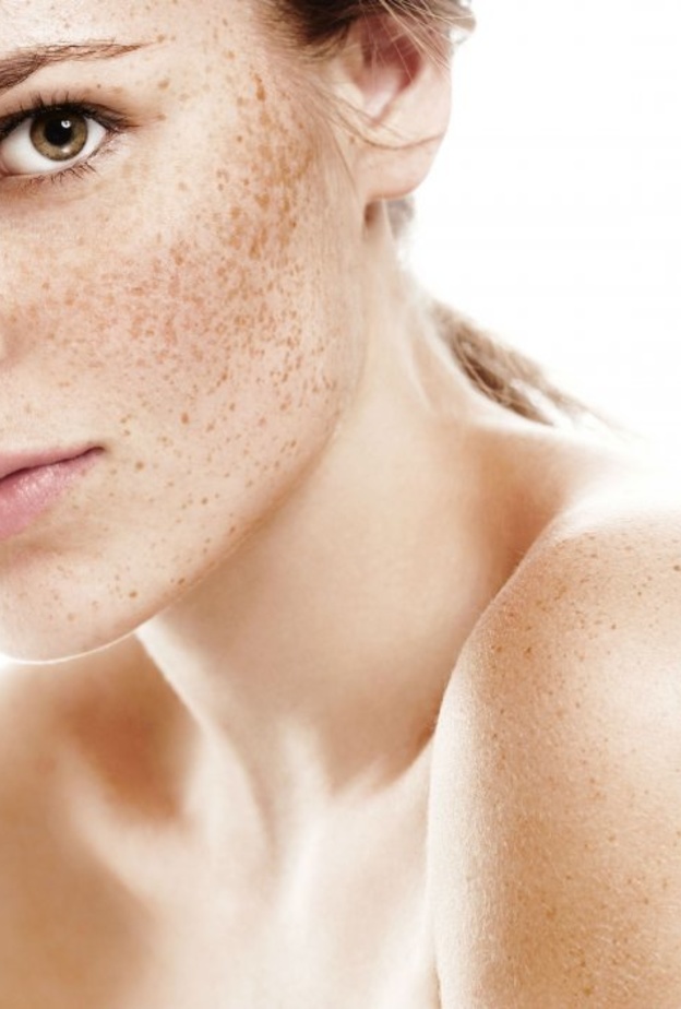 وصفات طبيعية لعلاج النمش وبهتان البشرة قبل بدء رمضان