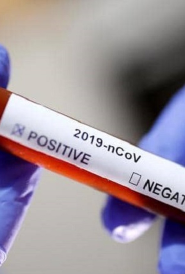  الاجسام المضادة لم تثبت فعاليتها في علاج كورونا