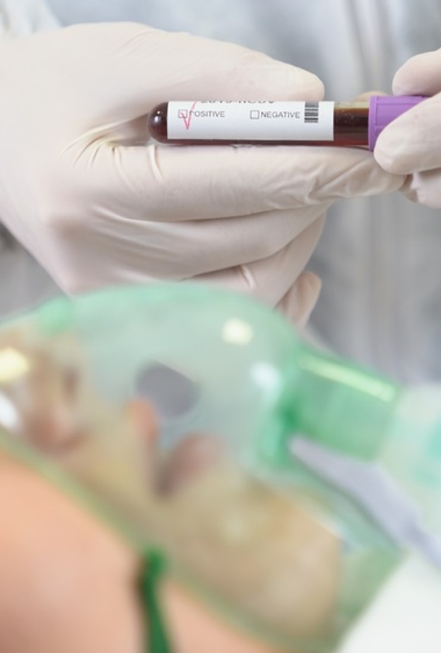 دور جهاز التنفس الصناعي في مواجهة فيروس كورونا