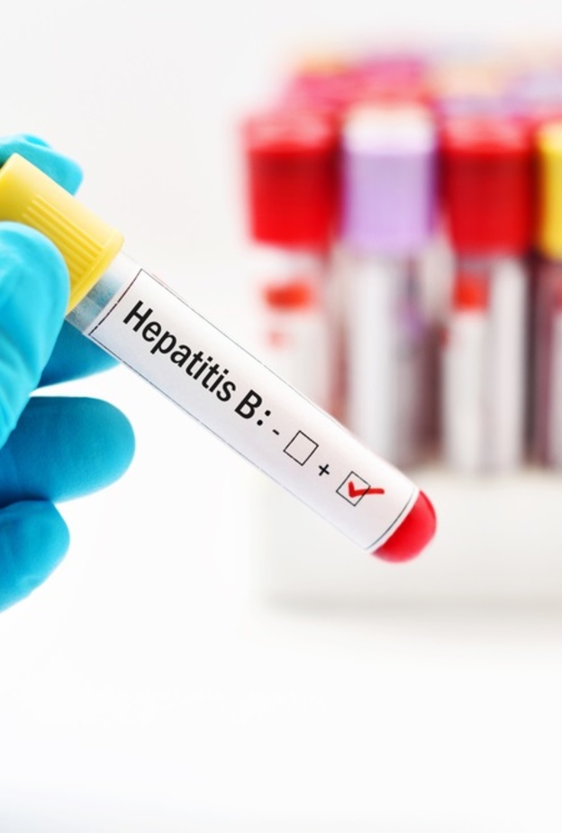 اسباب التهاب الكبد الوبائي ب