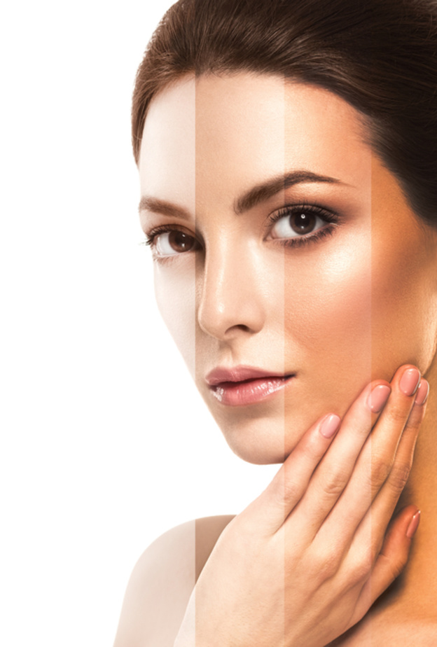 استخدمي الوصفات الطبيعية لتخفيف حروق الشمس