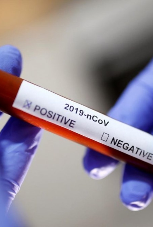  الدراسات تكشف عن أضرار جديدة لفيروس كورونا