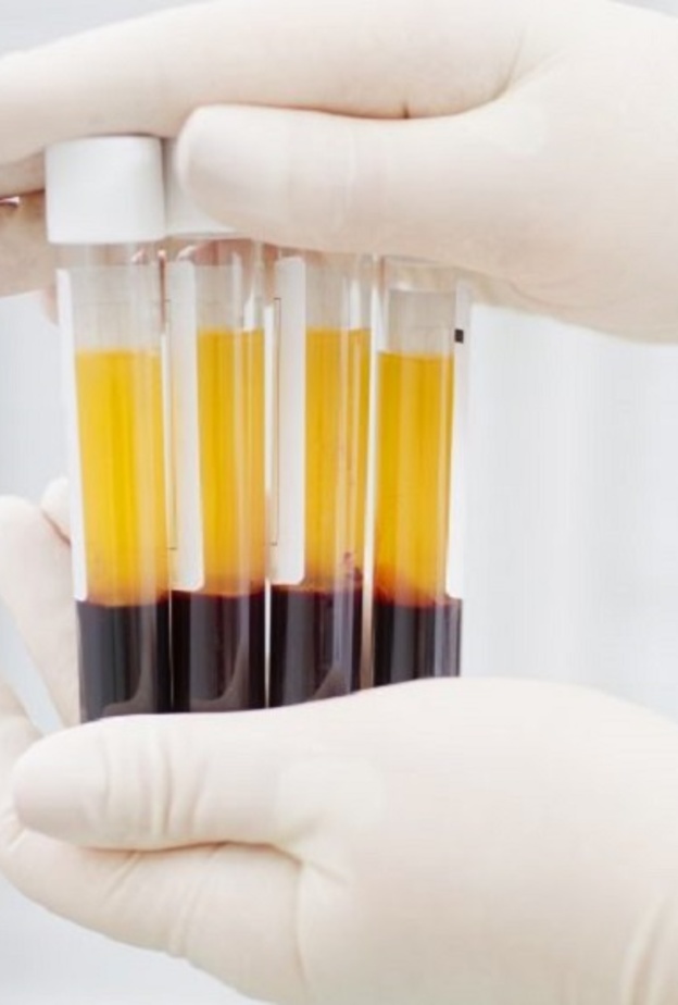 اهم المعلومات عن علاج كورونا ببلازما المتعافين