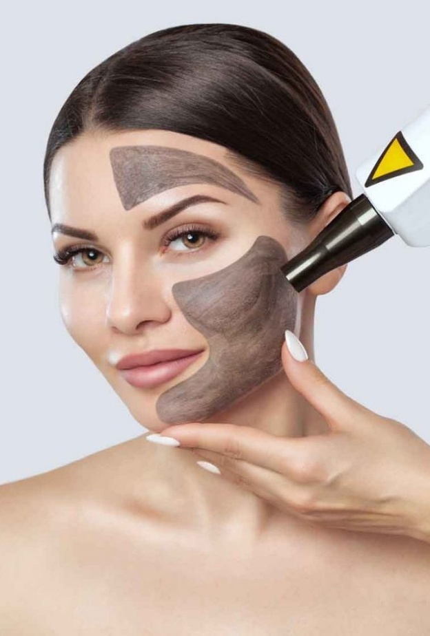 أهم فوائد الليزر الكربوني للوجه