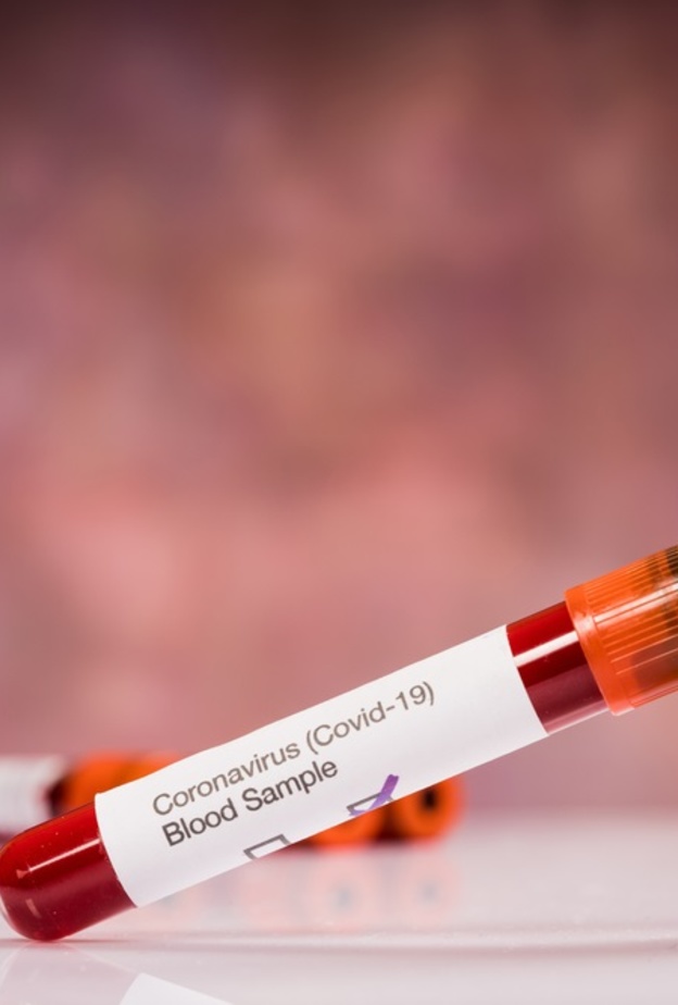 معلومات عن فصيلة الدم a الأكثر عرضة للإصابة بفيروس كورونا؟