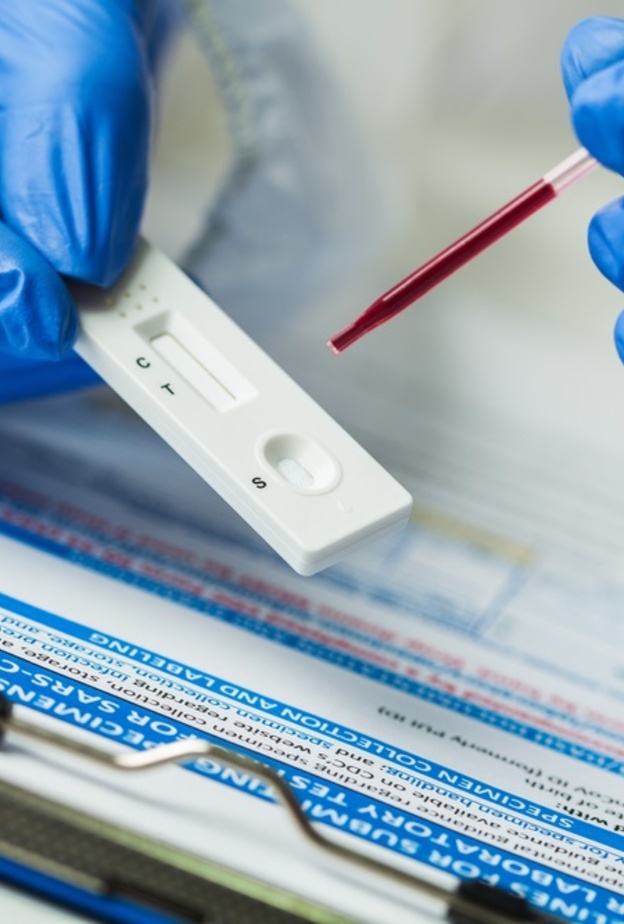 الأجسام المضادة يمكن أن تحمي نصف البشر من فيروس كورونا