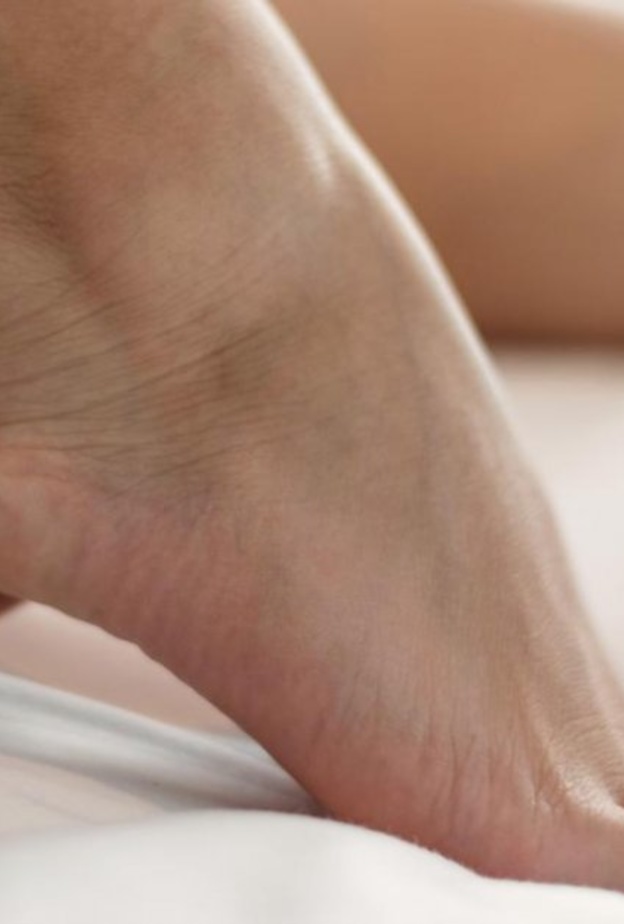 التهاب اللفافة الأخمصية يسبب آلام الكعب