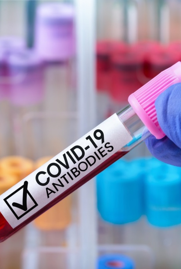 دماء حيوان اللاما تقلل نشاط فيروس كورونا