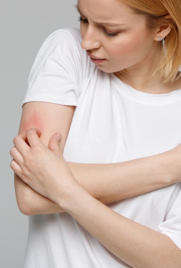 الطفح الجلدي احد ابرز اعراض فيروس كورونا