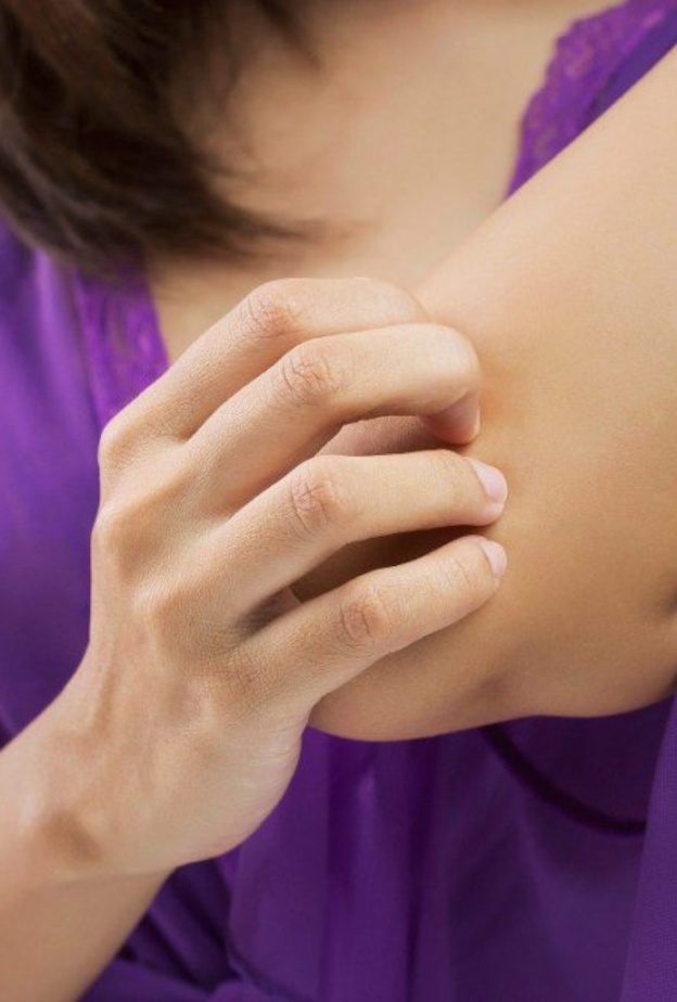  دراسة تؤكد أن البعوض لا ينقل فيروس كورونا