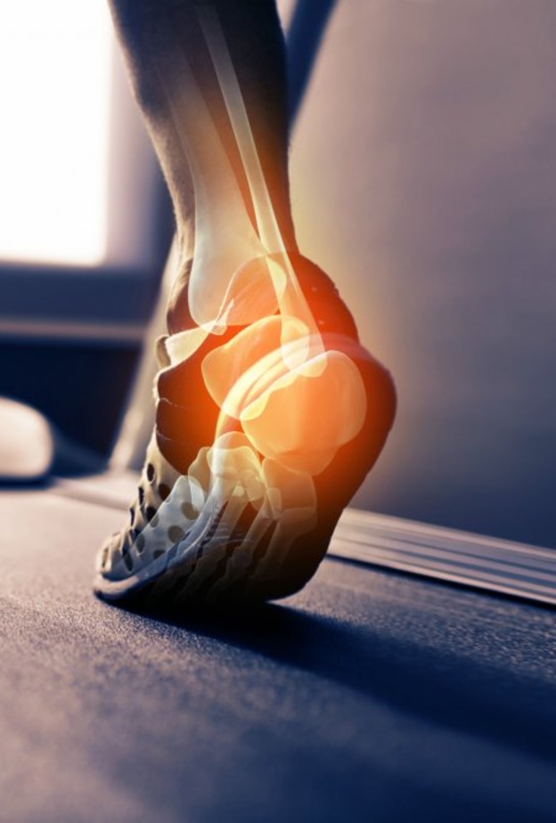 أسباب ألم كعب القدم عند النساء