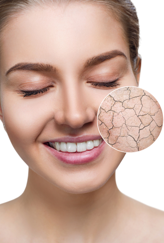 العناية بالبشرة الجافة