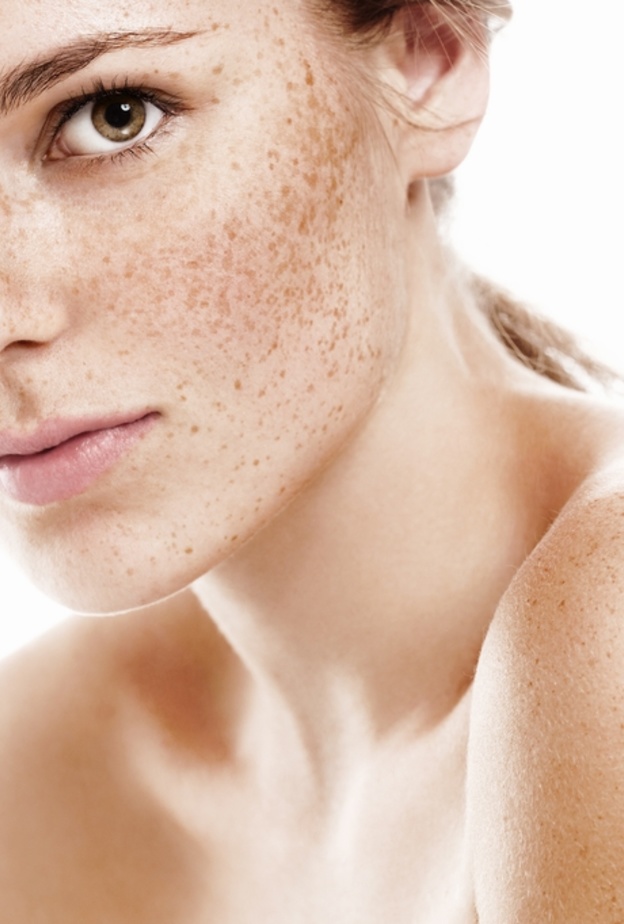 استخدمي زيت اللوز لإزالة النمش