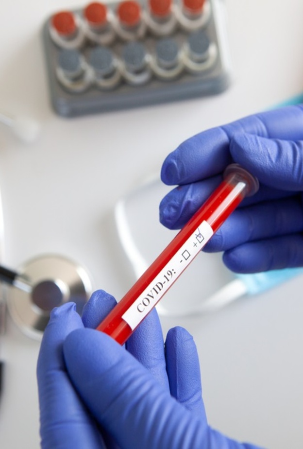 مؤشرات حيوية تكشف خطر الوفاة نتيجة الاصابة بكورونا