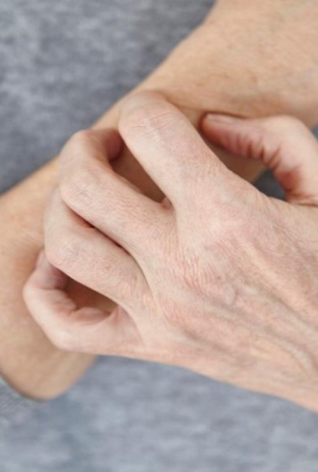 الحكة وإحمرار الجلد من أبرز أعراض الأكزيما الجلدية