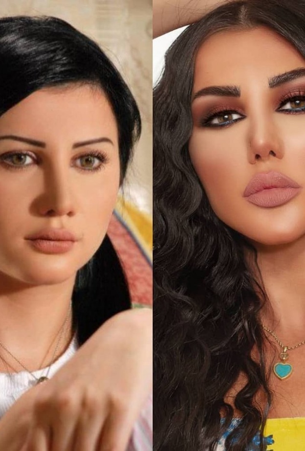 صور جيني اسبر قبل وبعد عمليات التجميل