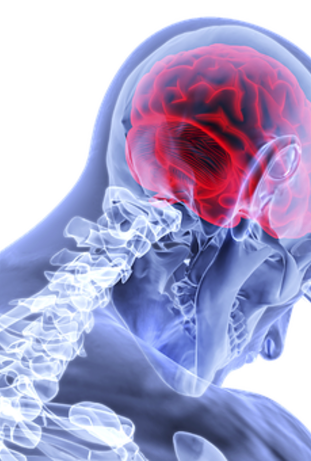عدم ممارسة النشاط البدني يزيد من فرص تعرضك للسكتات الدماغية