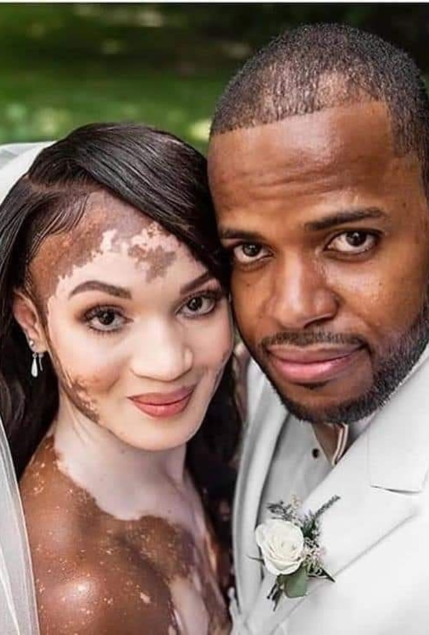 عروس تثير الإعجاب بلون بشرتها الفريد