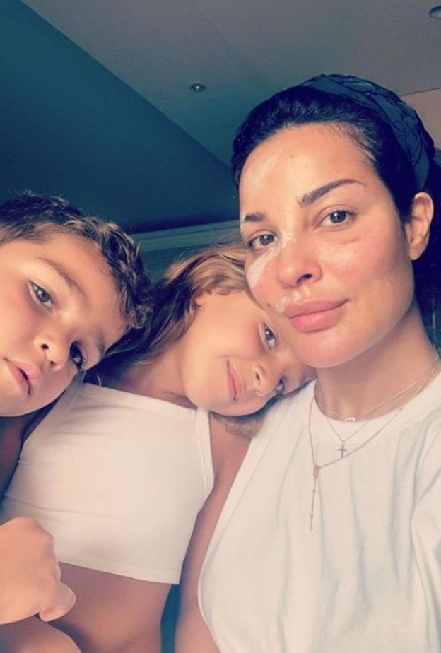 بعد مرور شهر على إصابتها في إنفجار بيروت أطلت نادين نجيم بلوك كاجول مع طفليها