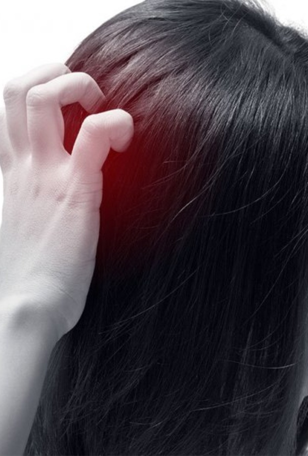  اعراض الاكزيما الدهنية في فروة الرأس واهم اسبابها وطرق علاجها