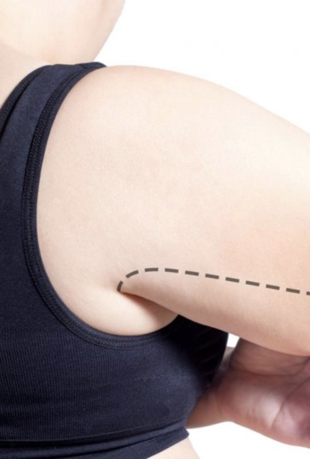  أهم مضاعفات عملية شد الذراعين والآثار الجانبية