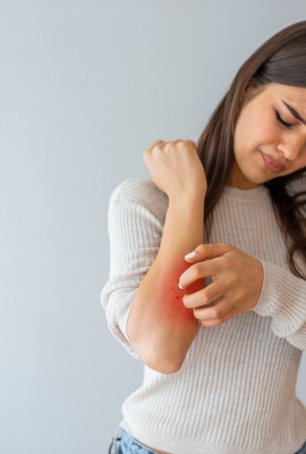 ما هي الاكزيما العصبية واهم اسبابها وطرق علاجها