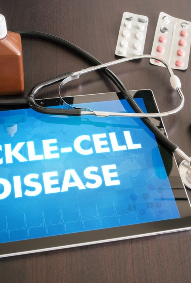 العلاج الوراثي والخلايا الجذعية لعلاج فقر الدم المنجلي