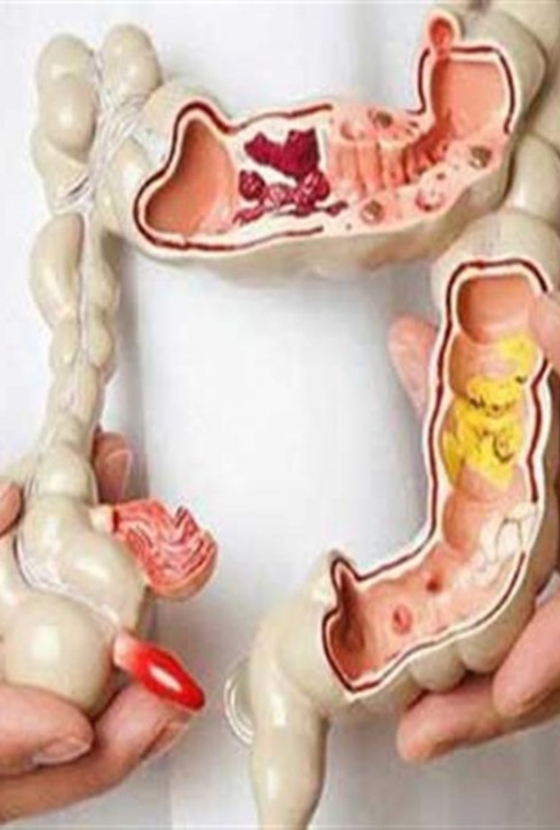  أهمية تنظيف القولون ومخاطره