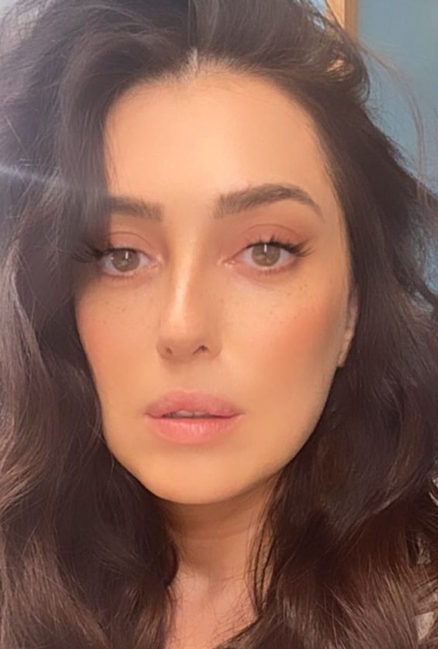 كندة علوش واتهامات لها بعمليات تجميل