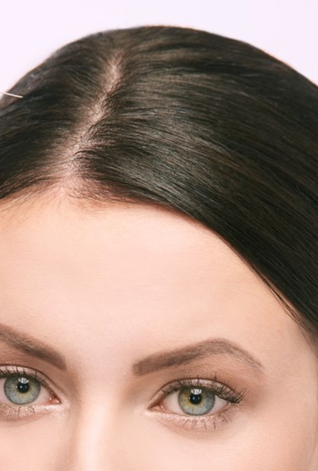  اسرار التقنيات التجميلية الحديثة لعلاج تساقط الشعر