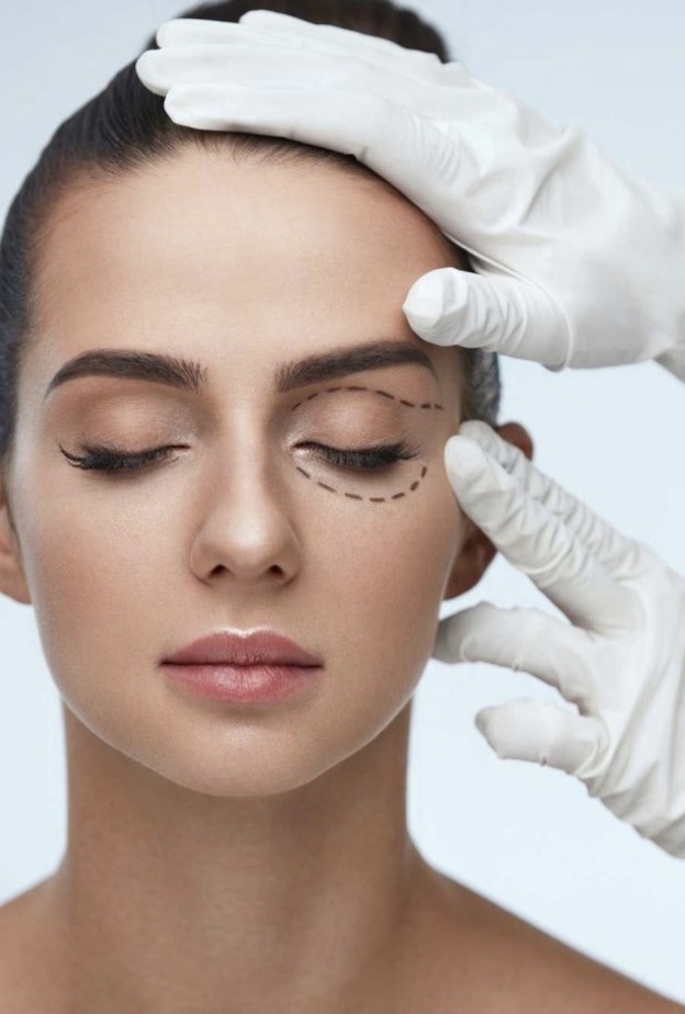 علاج الهالات السوداء حول العينين من خلال عملية شد الجفون