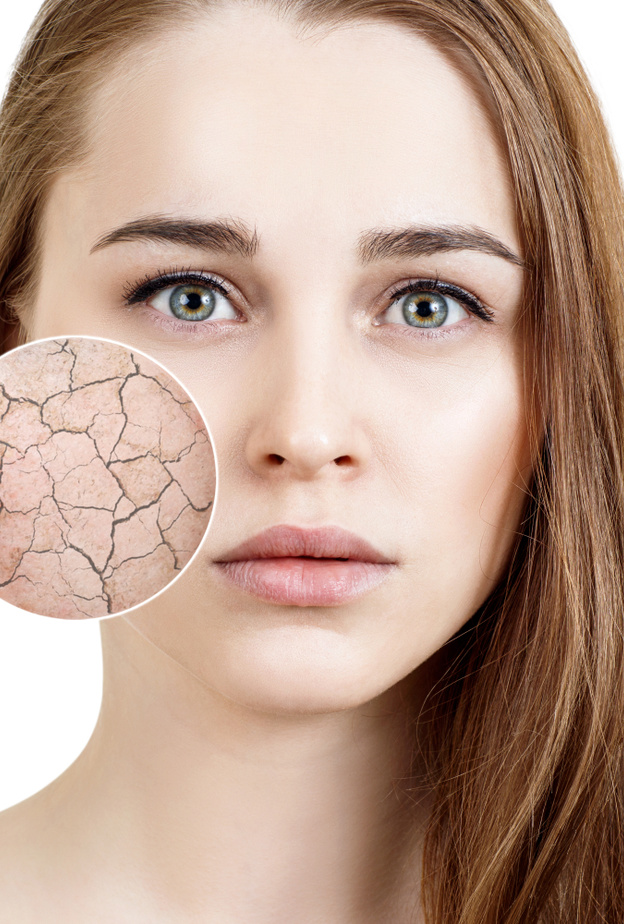 وصفات طبيعية لعلاج البشرة الجافة