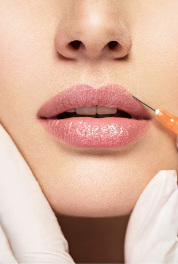 تكبير الشفاه جراحياً تتضمن حقن الشفاه بالدهون