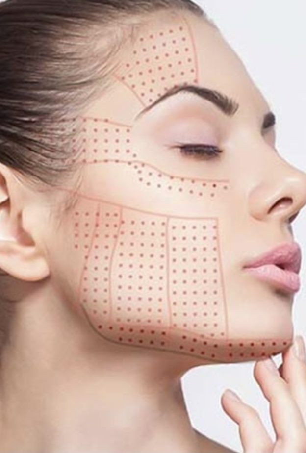 تعد تقنية الهايفو جزءاً من العلاجات المضادة للشيخوخة