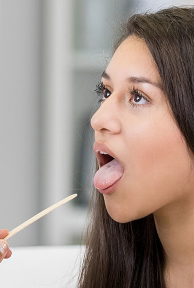  ماهي اسباب تغير اللسان الى الاصفر ومضاعفات ذلك