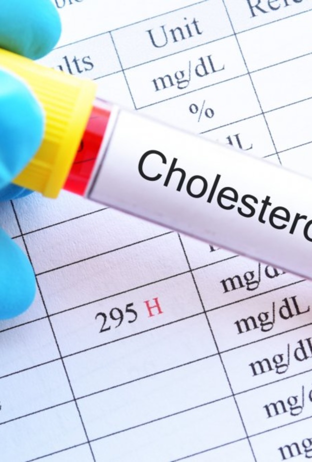 ماهي مضاعفات ارتفاع الكوليسترول الضار في الدم