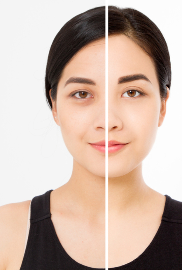 "الهالات السوداء"  تتحول  لصيحة جمالية رائجة