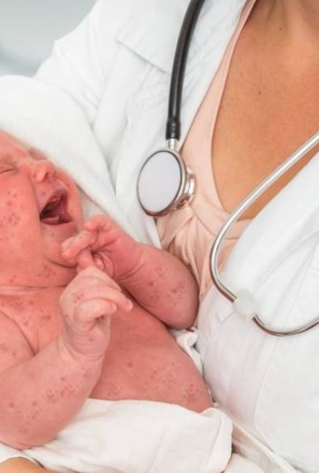 ازدياد حالات وفاة الأطفال بين مراحل العمليات