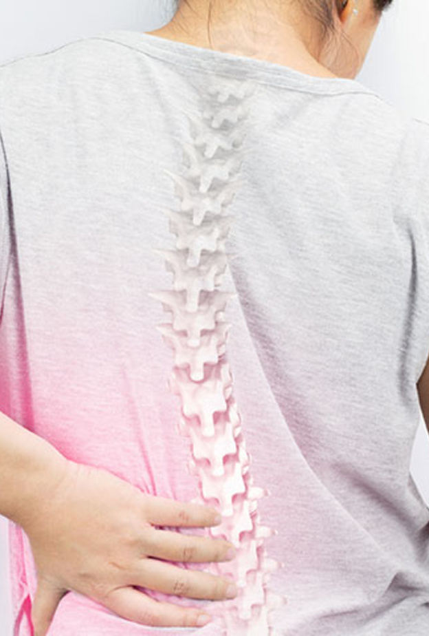 ماهي اعراض انحراف العمود الفقري وماهي الاسباب والمضاعفات