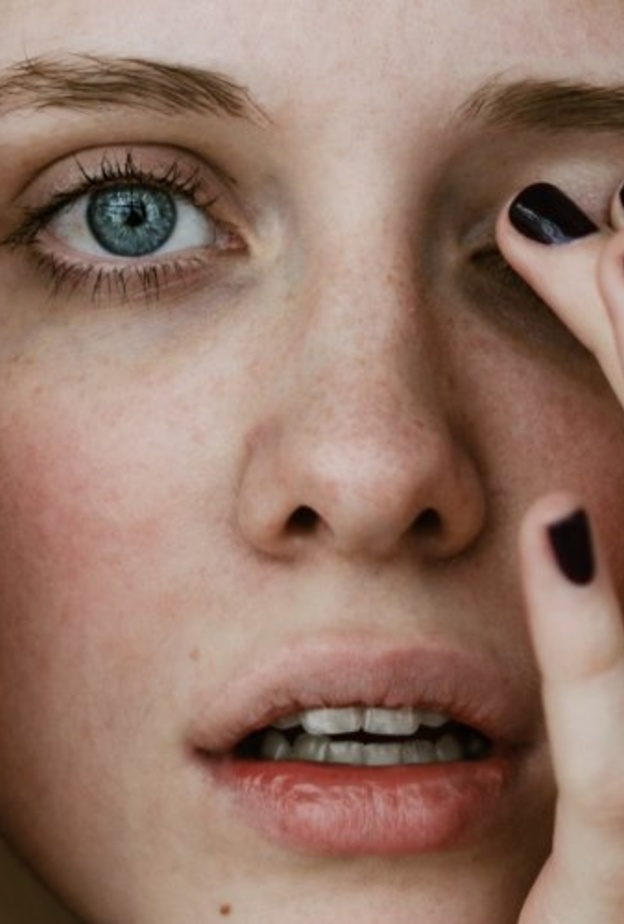  ماهي اسباب القرنية المخروطية وماهي الاعراض وكيف يمكن التشخيص