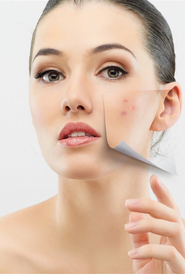 طرق التخلص وعلاج ندبات حب الشباب تجميلياً