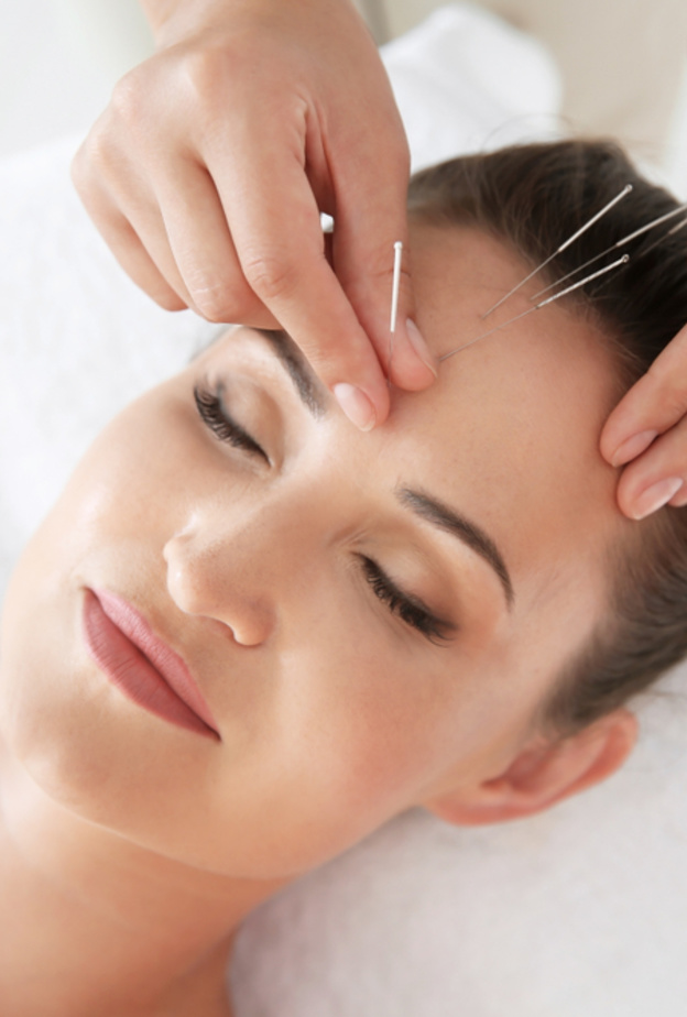 الإبر الصينية تساعد على تقليل التوتر