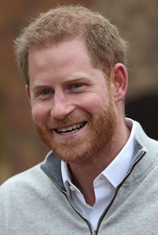 هل خضع الأمير هاري لعمليات تجميلية وتحسينية بسيطة للمظهر