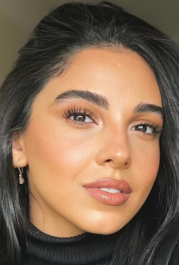 سلمى أبو ضيف تتعرض لحروق في جسدها