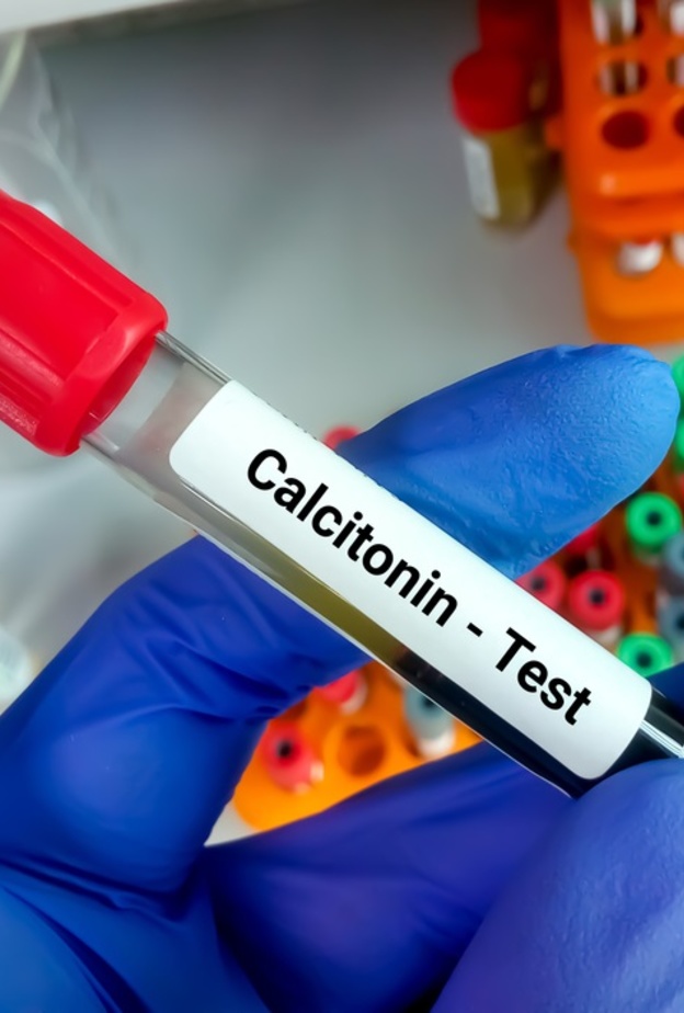  ما هو هرمون الكالسيتونين وما هي الاسباب المرضية وراء الزيادة في افرازه